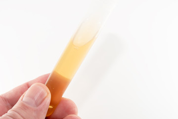 Transparent test tube in a male hand on a white background. Analysis of urine