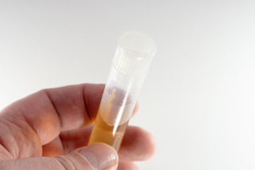 Transparent test tube in a male hand on a white background. Analysis of urine