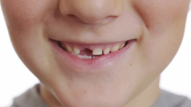 The boy mouth without a tooth. Baby teeth. Changing teeth. Oral care. Closeup, 6k.