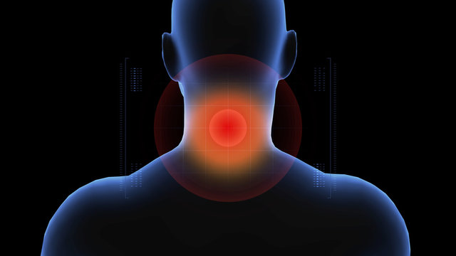 Man with pathology. 3d body of boy. Male human figure.