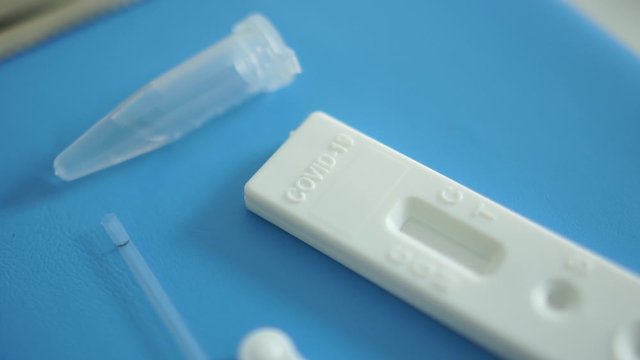 Unpacked set of rapid test Covid-19 lies on the table of the microbiologists laboratory assistant. Preparation for a blood test. Diagnosis of coronovirus sars-cov-2