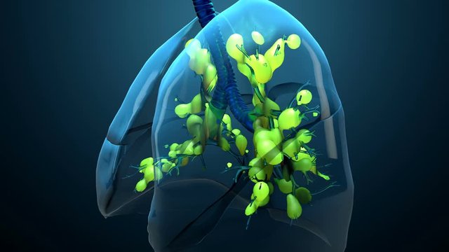 Damage lungs, severe respiratory illness, pneumonia, ARDS, acute respiratory distress syndrome caused by the coronavirus