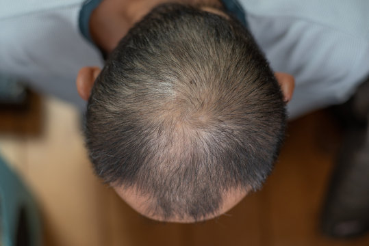 522 Best 後頭部 Images Stock Photos Vectors Adobe Stock