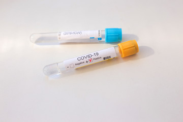 Covid-19 Blood Sample on white background. Covid-19