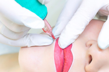 Young woman having permanent makeup on her lips at the beauticians salon. Permanent Makeup (Tattoo). drawing a contour with a white lip pencil