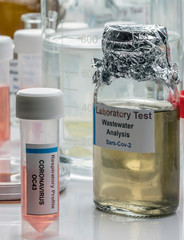 Wastewater samples, analysis of sars-cov-2 virus in patients infected by human coronavirus 229E, conceptual image