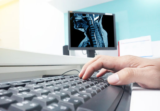 Blurred closeup hand Doctor  on the keyboard taking the MRI Cervical spine.result to the patient.