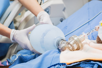 Doctor holding oxygen ambu bag over patient given oxygen to patient by intubation tube in...