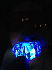 tooth whiteninig dentist