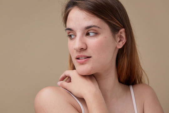 Sensitive skin beauty portrait