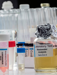 Wastewater samples, analysis of sars-cov-2 virus in patients infected by human coronavirus 229E, conceptual image