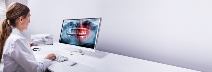 Zahnarzt, der auf dem Computer eine Röntgenaufnahme der Zähne betrachtet