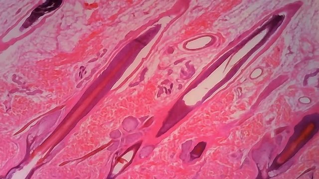 Microscope Human Skin Hair Follicle 1000x