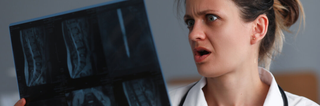 Portrait of experienced surprised pediatrician holding skiagram of unhealthy person. Doctor looking at snap with horrified. Healthcare and medicine concept