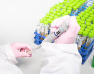 Obraz premium pipetting centrifuge tubes in a medical laboratory