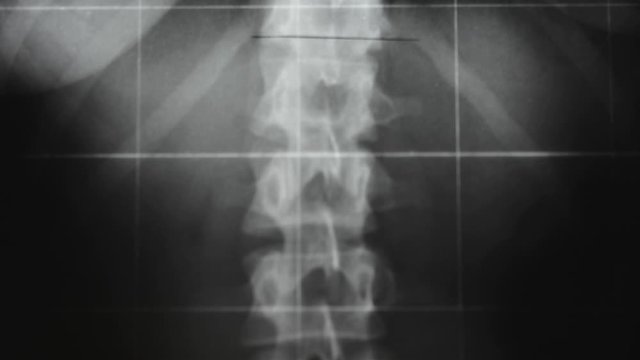 Human radiography for codiv virus diagnosis