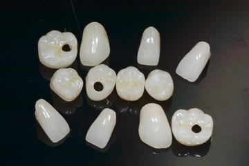 Dental mirror tool and zircon dentures on a black background