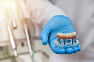 dental concept. the hands of a dentist doctor hold a model of teeth with a dental implant
