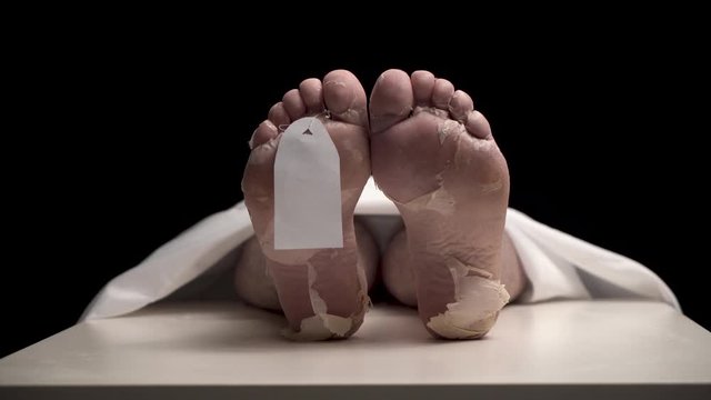 Slow zoom in on legs of corpse with white tag hung on finger. Man has long died and is awaiting decision on cremation or burial in morgue. A person death is terrible, especially from epidemic.