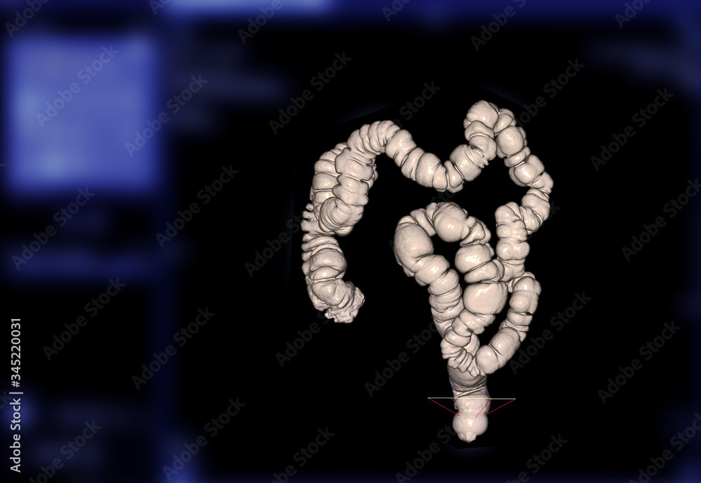 Poster ct colonography or ct scan of colon 3d rendering image.