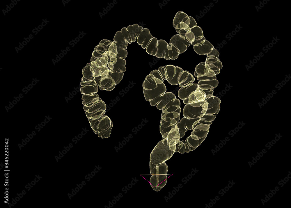 Poster ct colonography or ct scan of colon 3d rendering image.