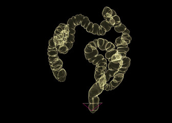 CT colonography  or CT Scan of Colon 3D Rendering image.