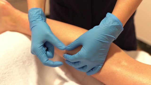 Hands of physiotherapist doing a dry needling