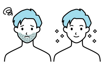 男性 ひげ ビフォーアフター