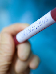 Hand holding blood test result for Coronavirus