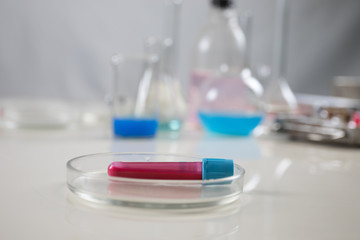 Positive blood test result for the new rapidly spreading Coronavirus, originating in Wuhan, China