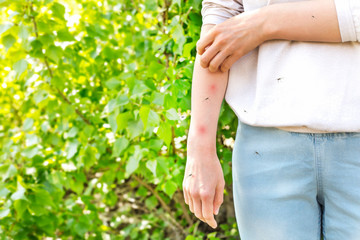 Mosquito bites cause allergies in women. Itchy skin. - 345325036