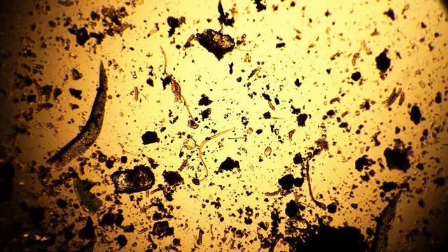 Two different worms in a dirty drop of water under a microscope. Theme of study of environmental pollution and microorganisms in lab research under microscope. Microscopic protozoa in a drop of water.
