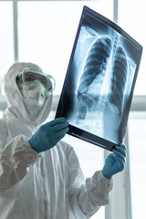 COVID-19, Coronavirus or Novel corona virus epidemic disease with doctor or lab technician scientist in PPE Personal Protective Equipment holding lung chest X-ray image in hospital laboratory