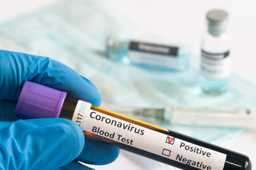 Hand holding testing patients blood samples for Coronavirus Outbreak (COVID-19) in laboratory, New coronavirus 2019-nCoV