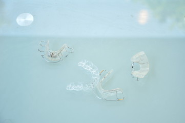 歯科矯正の種類