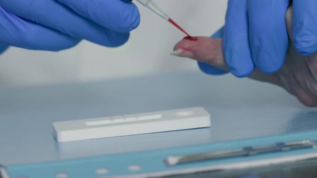 A laboratory technician using a finger-prick antibody whole blood test kit to determine if the subject has been exposed to COVID19 in the recent past.