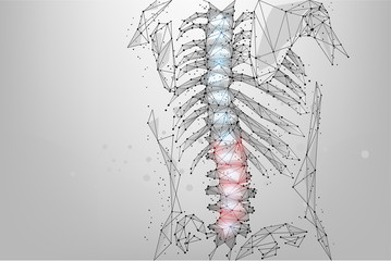 Abstract mesh line and dot physiotherapy human spine. Low poly Pain area surgery operation. Polygonal render female back hernia illustration - obrazy, fototapety, plakaty