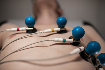 A patient with EKG electrodes attached to his body.