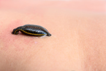Tropical land leech sucking some blood from the skin.