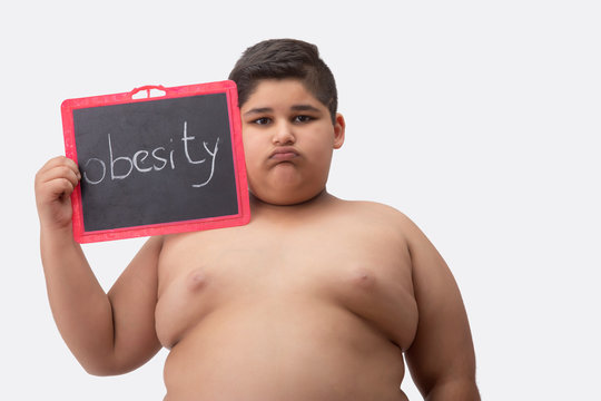Young boy bare chested holding a small blackboard with obesity written on it. 	