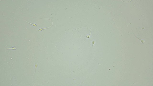 Human sperm under a microscope (spermatozoa), consists of sperm and seminal fluid, also contains various substances: antibodies, cholesterol, choline, citric acid, fructose and DNA ...