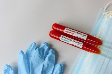 Blood test samples for presence of virus COVID-19, tubes containing a blood sample with positive and negative for coronavirus. Conceptual image - medical mask, gloves, infected sample test.