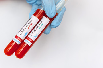 Obraz premium Coronavirus covid 19 infected blood sample in tubes in hand of scientist on white background. New virus covid-19 vaccine research. Positive and negative results of tests.