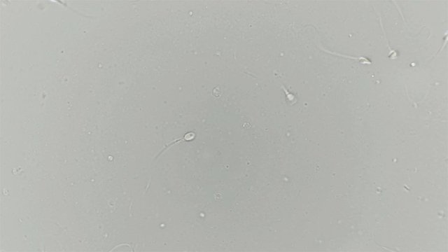 Human sperm under a microscope (spermatozoa), consists of sperm and seminal fluid, also contains various substances: antibodies, cholesterol, choline, citric acid, fructose and DNA ...