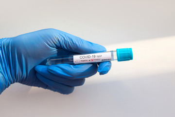 Coronavirus test in doctors hand on white background