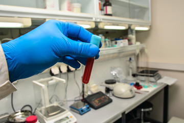 Blood testing in the laboratory.