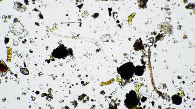 A large nematode worm moves in dirty water close up under a microscope. Theme of laboratory biological research under microscope. Microscopic protozoa with a visible organ system in a drop of water.