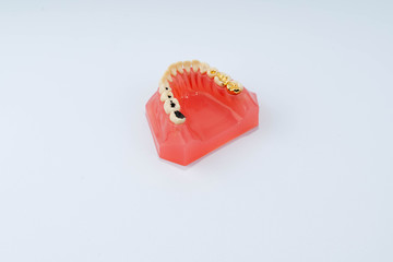 Dental education and study model of teeth.