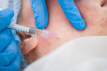 Injection cosmetology. Doctor makes an injection into the skin of the face close-up.