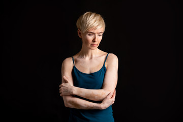 Woman does not admit her body with vitiligo